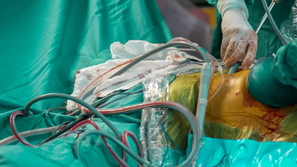 Asuransi kesehatan berperan penting dalam mengatur keseimbangan antara biaya pelayanan medis dan akses pasien terhadap perawatan berkualitas.