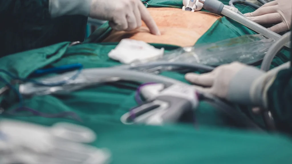 Kombinasi antara Augmented Reality (AR) dan Artificial Intelligence (AI) membawa revolusi besar dalam dunia bedah laparoskopi.