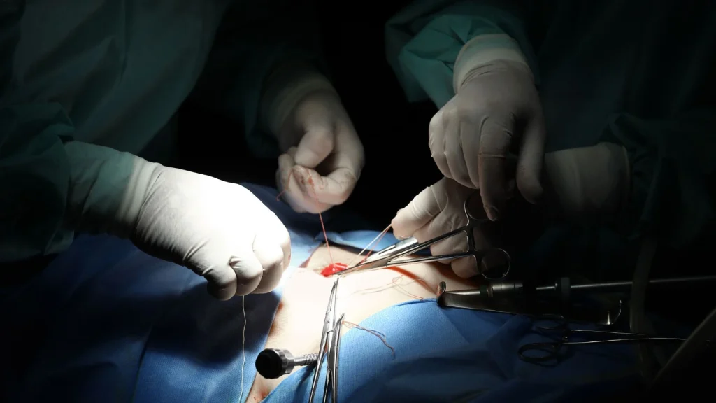 Perkembangan teknologi digital telah membawa dunia bedah ke arah yang semakin futuristik melalui konsep Virtual-Enhanced Laparoscopy berbasis Augmented Reality (AR).