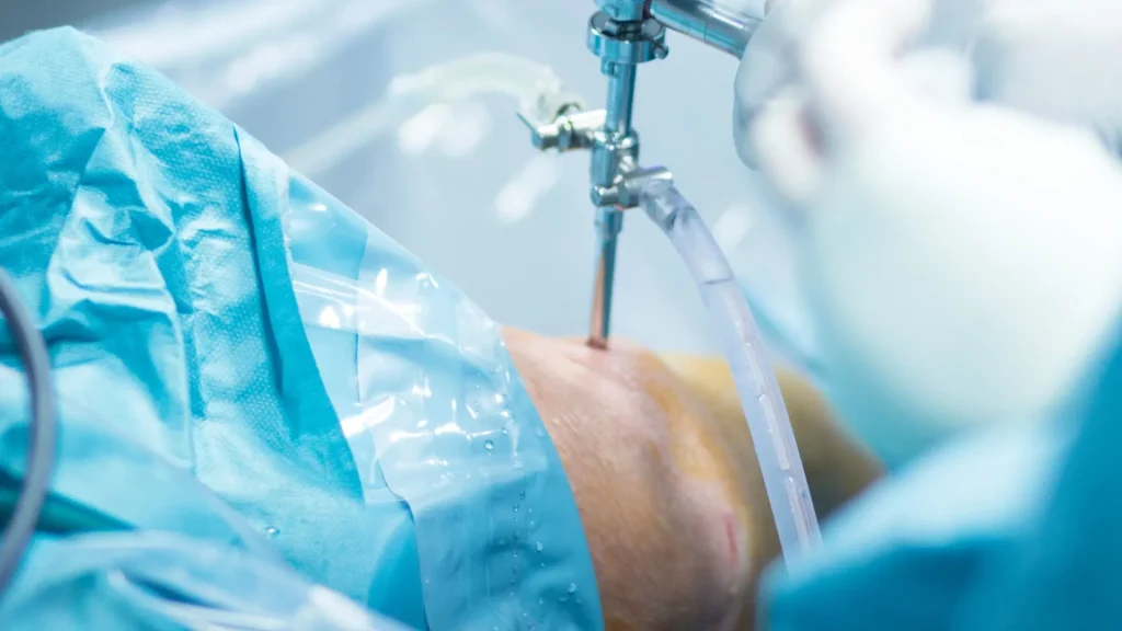 Operasi robotik merupakan inovasi besar dalam dunia bedah modern yang menawarkan tingkat presisi dan kontrol tinggi.