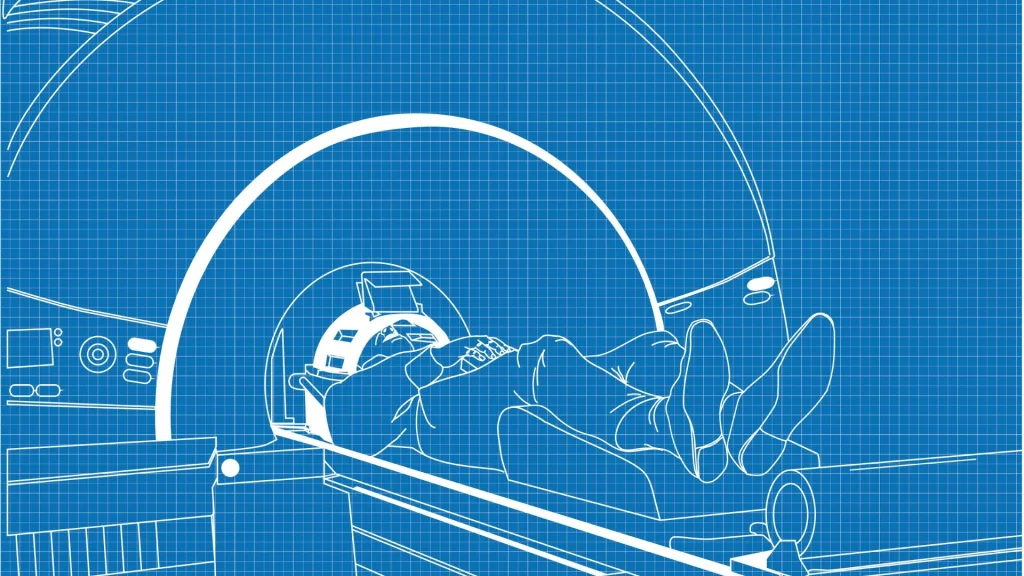Teknologi MRI 3 Tesla menghadirkan sejumlah tantangan teknis yang perlu diatasi dalam implementasinya di fasilitas kesehatan modern.
