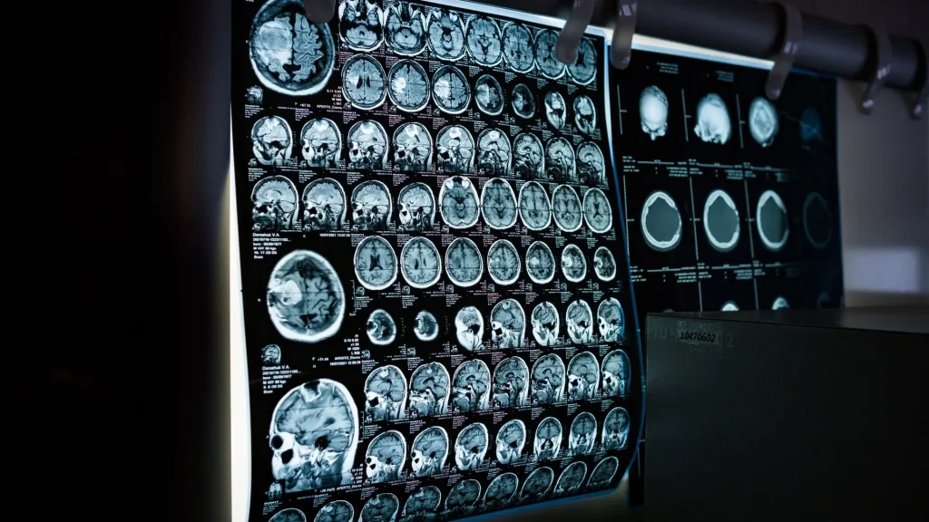Digital Radiography (DR) wireless menjadi salah satu teknologi yang membawa perubahan besar dalam alur kerja radiologi modern.