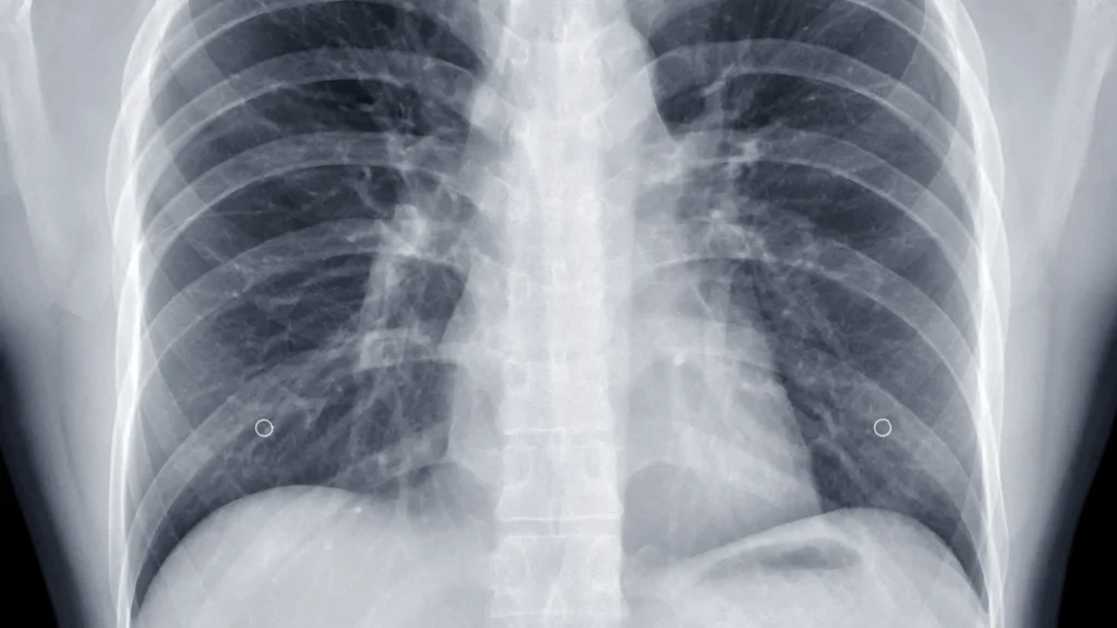 DR wireless memberi kemampuan mobilitas yang sangat dibutuhkan dalam lingkungan ICU yang penuh keterbatasan ruang dan pasien dengan kondisi kritis.