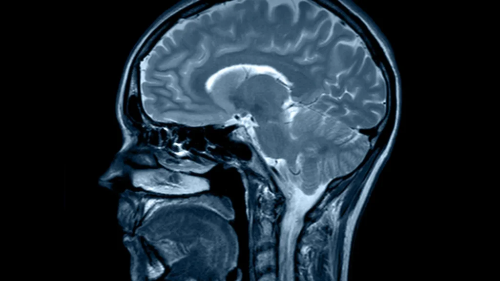 Penerapan teknologi low-dose pada digital X-ray menjadi langkah penting untuk meningkatkan keamanan pasien tanpa mengorbankan kualitas gambar.