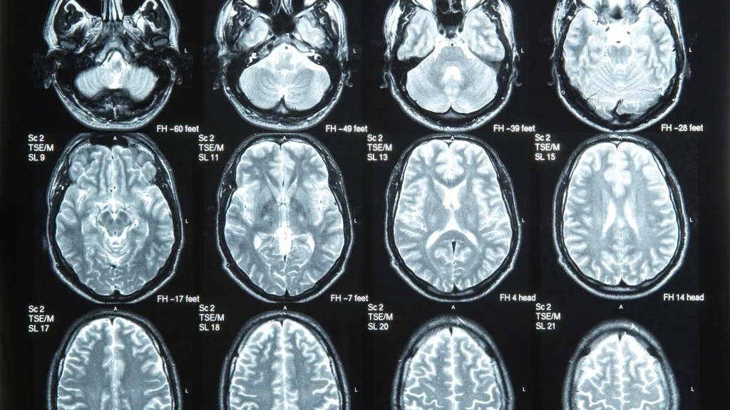 Penerapan AI dalam digital radiography memberikan dukungan analisis yang lebih cepat dan terstruktur, terutama pada pemeriksaan dada yang memiliki volume kasus sangat tinggi.