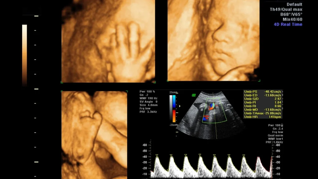 USG dengan AI Auto Measurement memungkinkan dokter melihat jantung janin secara real-time dengan detail tinggi.