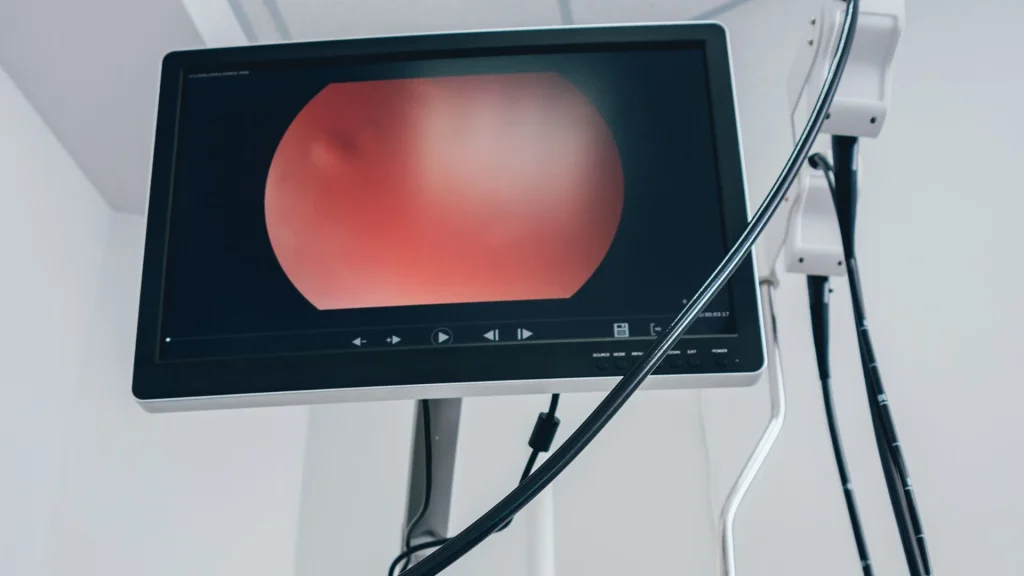 Narrow Band Imaging (NBI) dan white light endoscopy memiliki prinsip kerja yang berbeda dalam menampilkan struktur mukosa.