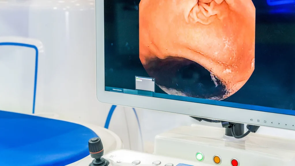 Endoskopi 4K menghadirkan peningkatan signifikan dalam visualisasi struktur anatomi sinus yang kompleks.