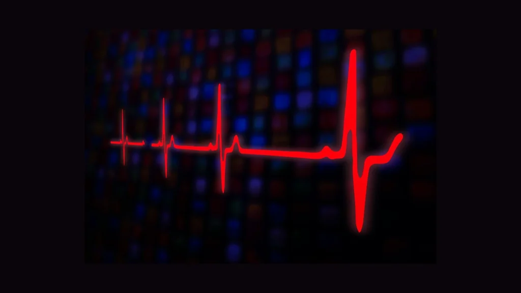 ECG 24 lead menyediakan cakupan kelistrikan jantung yang lebih luas dibandingkan konfigurasi standar.