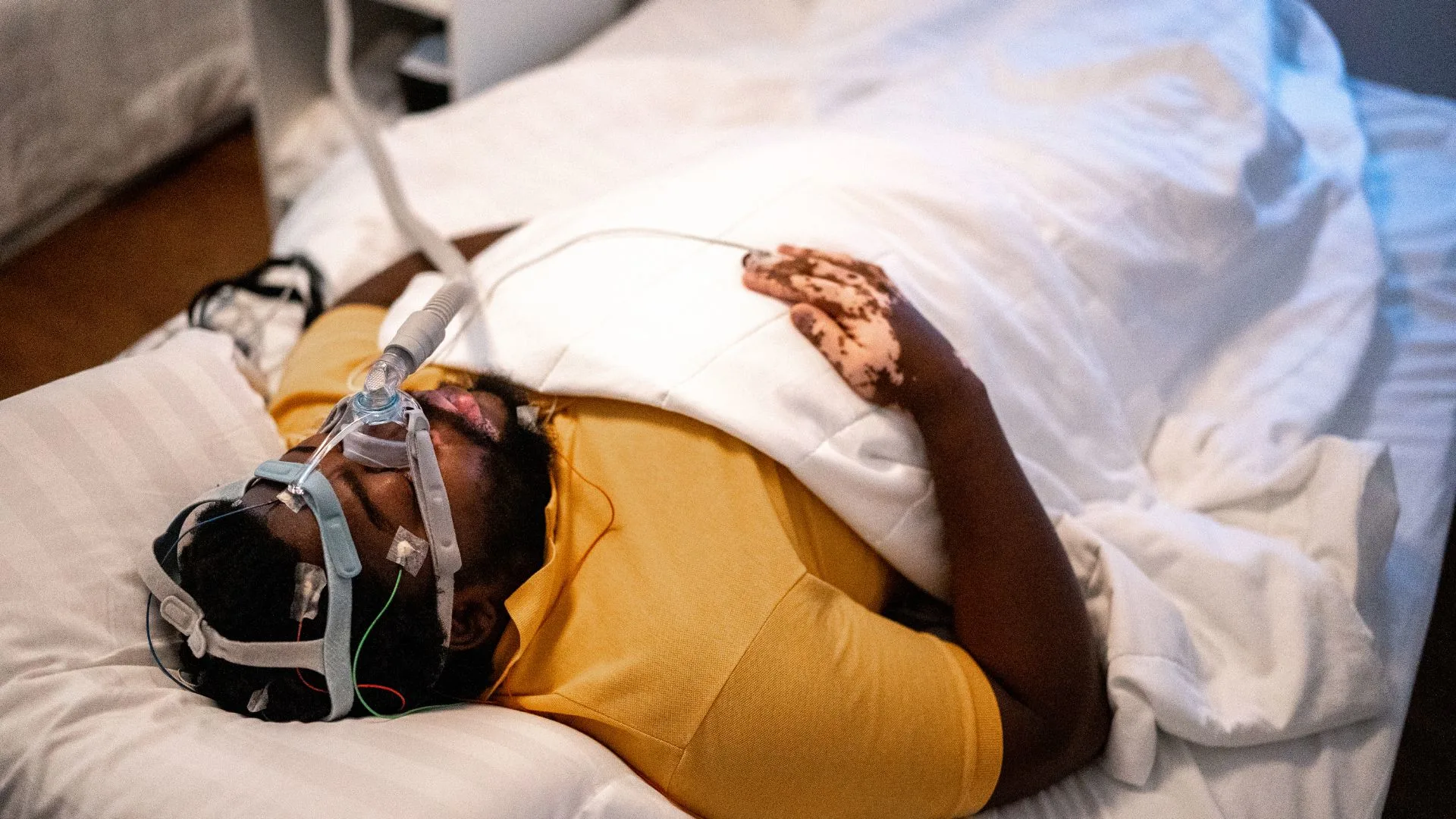 Sleep apnea merupakan gangguan tidur yang sering tidak terdiagnosis secara optimal.