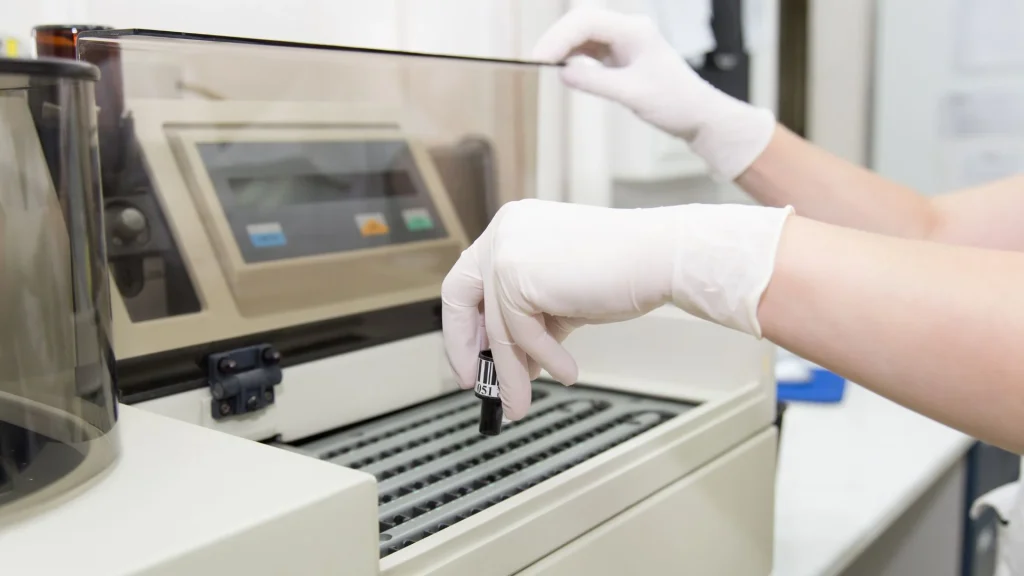 Chemiluminescent Immunoassay (CLIA) telah menjadi salah satu teknologi paling andal dalam diagnostik laboratorium karena mampu memberikan hasil yang sangat sensitif dan spesifik.