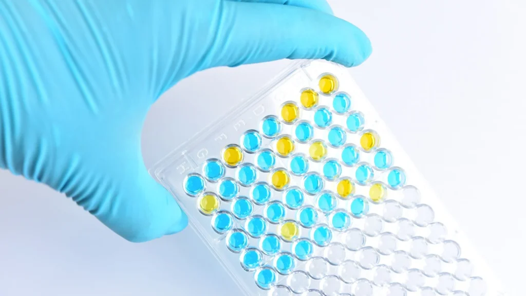 Integrasi CLIA analyzer ke dalam sistem laboratorium digital bertujuan meningkatkan akurasi, efisiensi, dan konsistensi diagnostik melalui konektivitas data yang terstruktur.