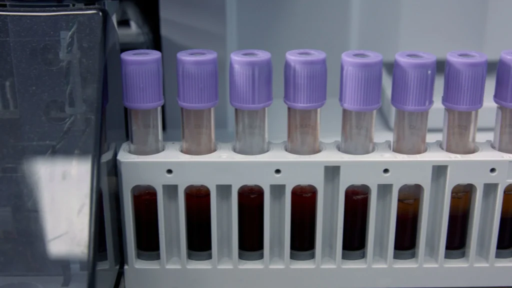 Inovasi pada hematology analyzer modern telah mendorong peningkatan signifikan dalam kualitas pemeriksaan laboratorium.