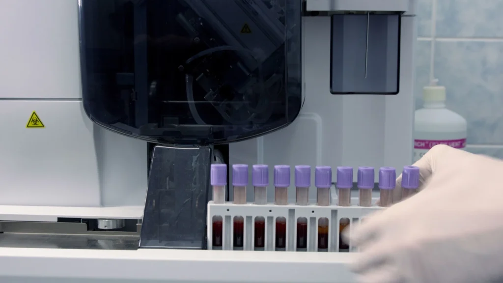 Analyzer hematologi menjadi perangkat utama dalam pemeriksaan laboratorium untuk menilai kondisi kesehatan pasien secara menyeluruh.