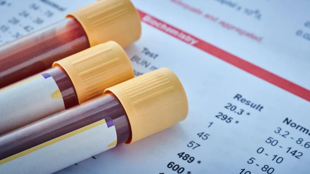 D-dimer merupakan fragmen protein hasil degradasi fibrin yang terbentuk ketika terjadi aktivasi sistem koagulasi dan fibrinolisis.