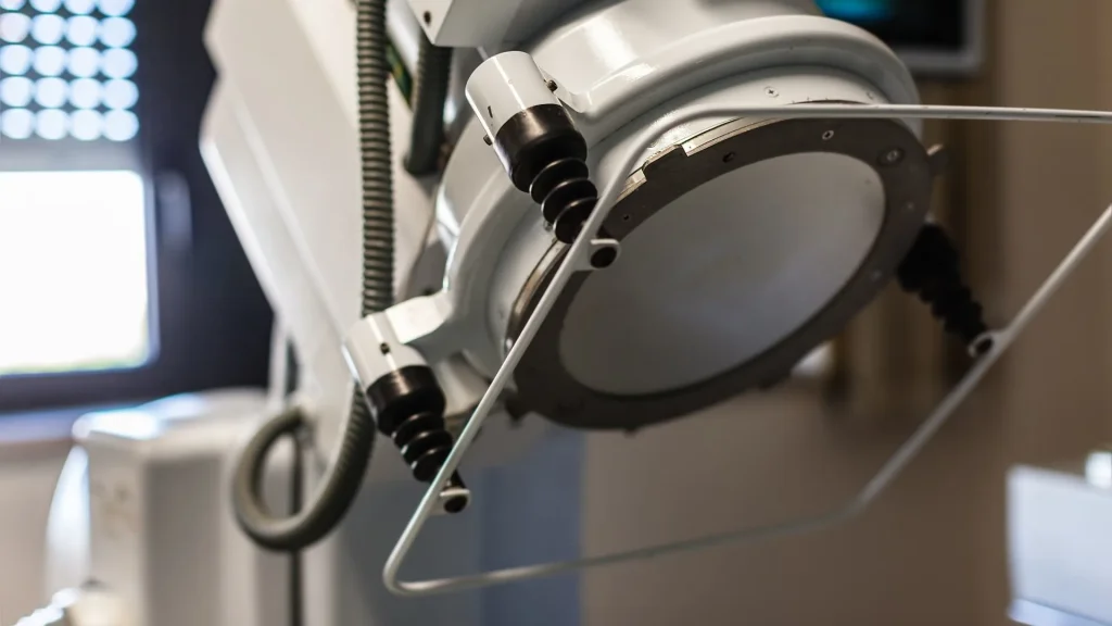 Teknologi lithotripsy generasi baru mengalami kemajuan signifikan dalam penanganan batu saluran kemih. Inovasi ini berfokus pada peningkatan akurasi penghancuran batu sekaligus meminimalkan dampak terhadap jaringan sekitar.