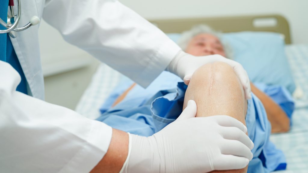 Tipe-Tipe Bone Graft dan Aplikasinya dalam Bedah Ortopedi
