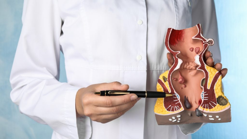 Kolonoskopi: Penting Periksa Rutin untuk Mencegah Kanker Usus