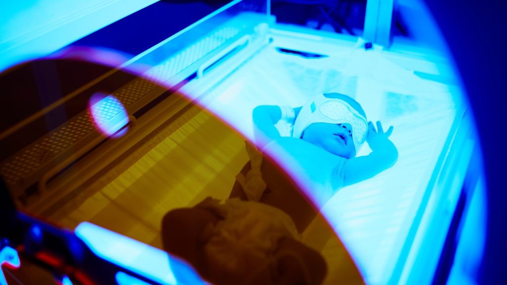 Lampu Fototerapi: Solusi Efektif Menangani Bayi Kuning