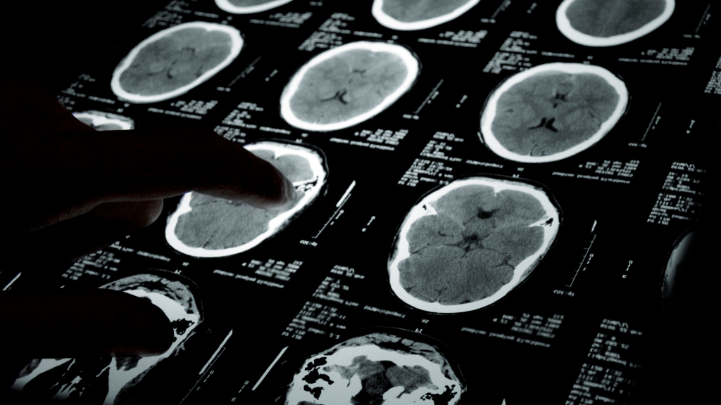 PET-CT dan AI: Masa Depan Diagnostik Berbasis Data dan Gambar Terpadu