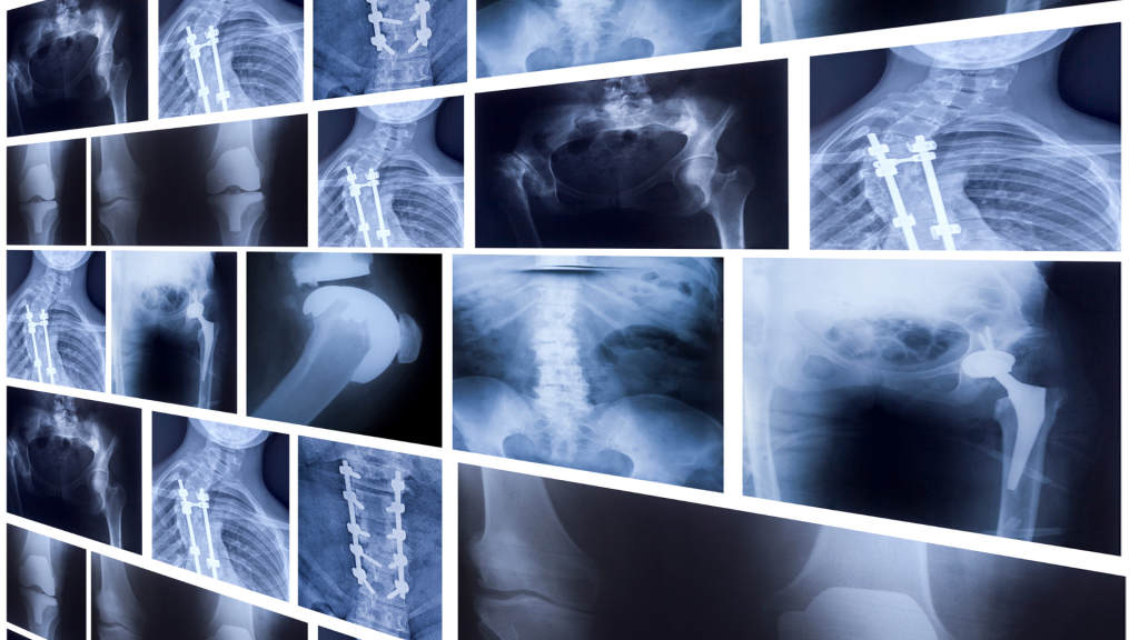DR System Wireless: Solusi X-Ray Modern untuk Workflow Radiologi yang Lebih Cepat