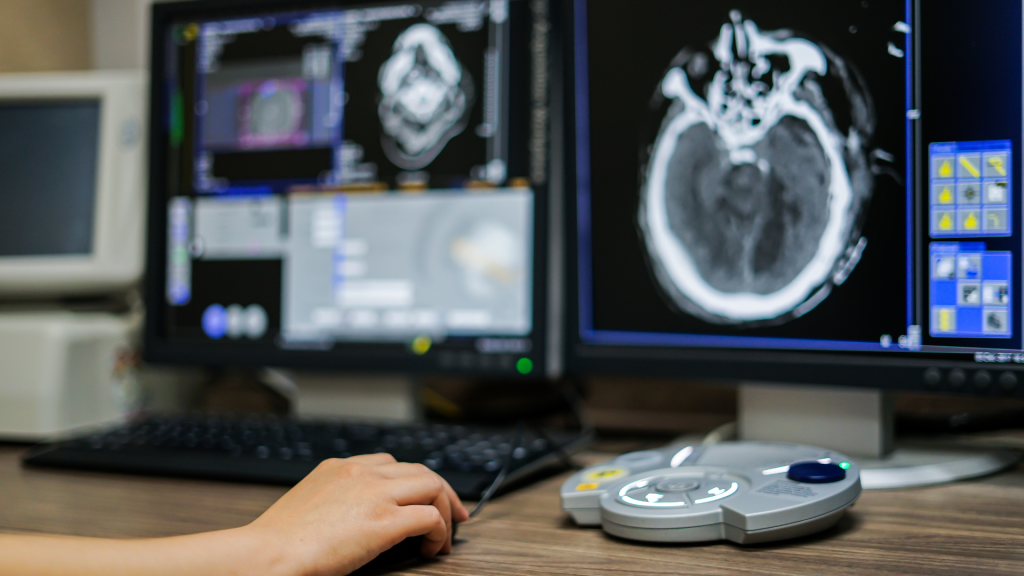 Deteksi Kanker Lebih Dini dan Akurat dengan Teknologi PET-CT Hybrid