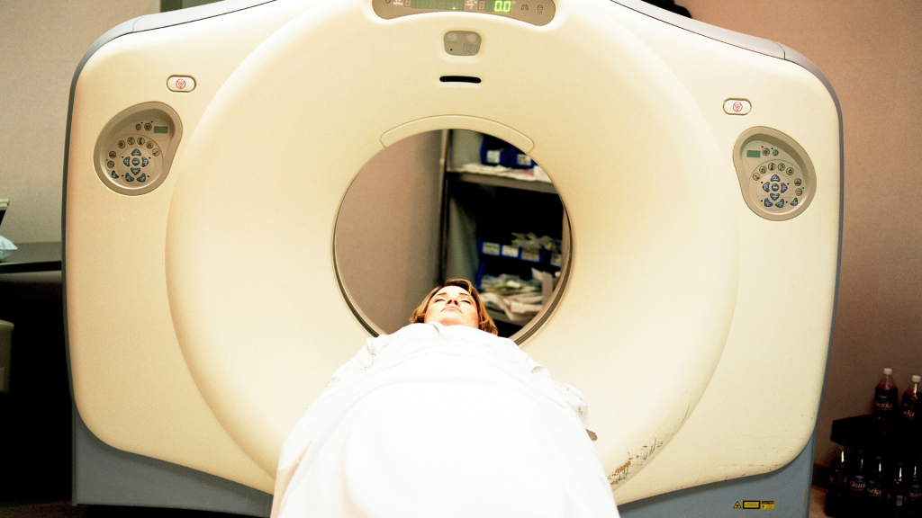 PET-CT untuk Neurologi: Visualisasi Aktivitas Otak dengan Ketajaman Struktural Tinggi