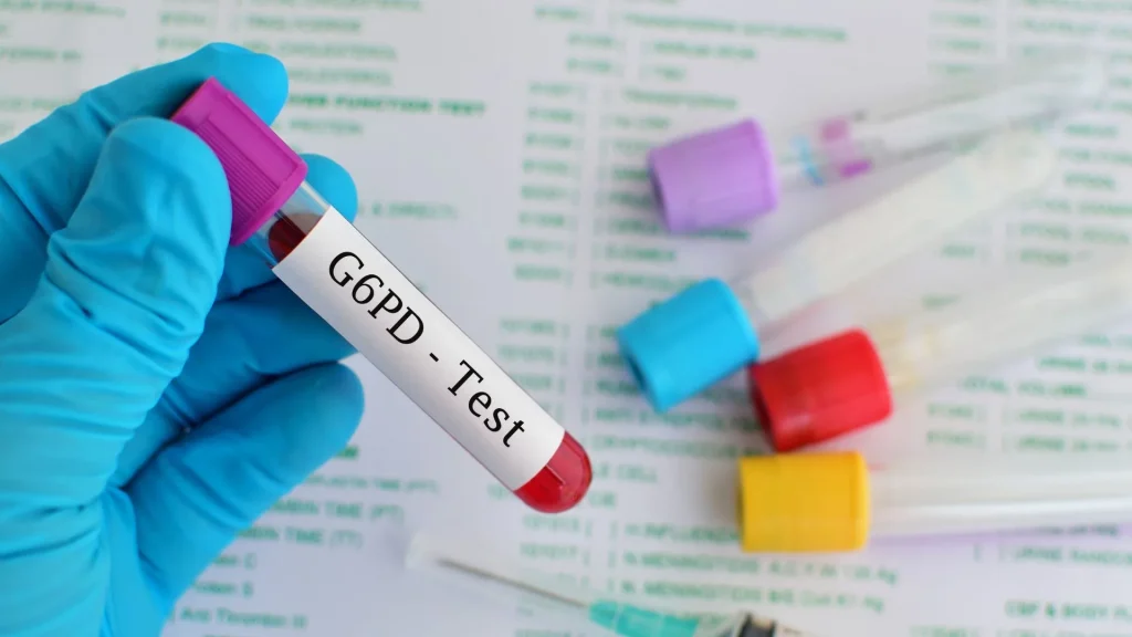 Defisiensi G6PD (Glucose-6-Phosphate Dehydrogenase) adalah kelainan genetik yang menyebabkan tubuh kekurangan enzim G6PD.