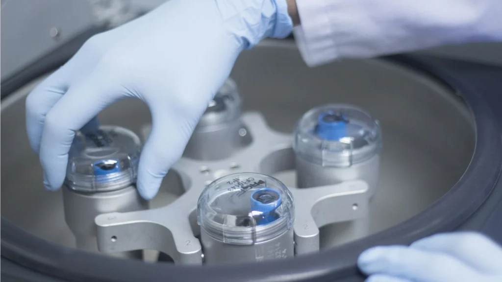 Tes platelet aggregation adalah pemeriksaan laboratorium yang digunakan untuk mengevaluasi seberapa baik trombosit (platelet) dalam darah berfungsi membentuk agregasi.