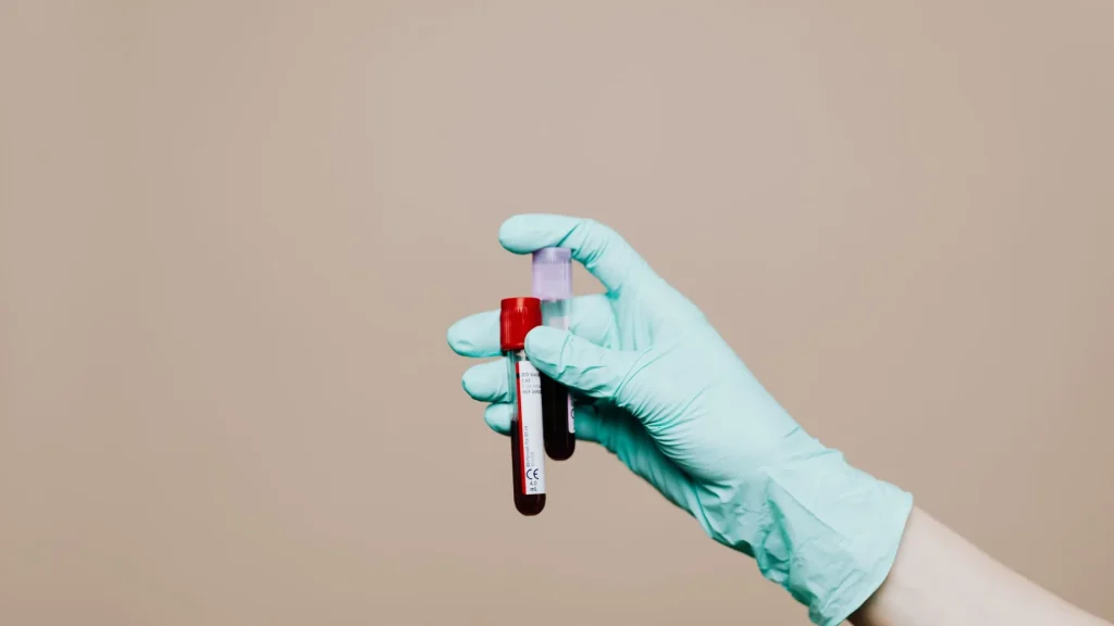 Pemeriksaan fibrinogen menjadi salah satu parameter penting dalam evaluasi sistem koagulasi darah.