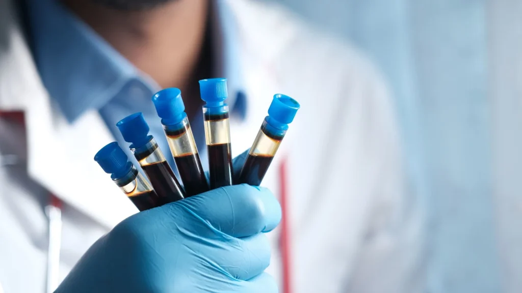 Fibrinogen merupakan protein plasma penting yang berperan dalam proses pembekuan darah.