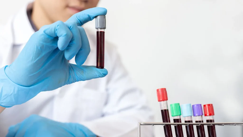 C-Reactive Protein (CRP) adalah protein yang diproduksi oleh hati sebagai respons terhadap peradangan dalam tubuh.