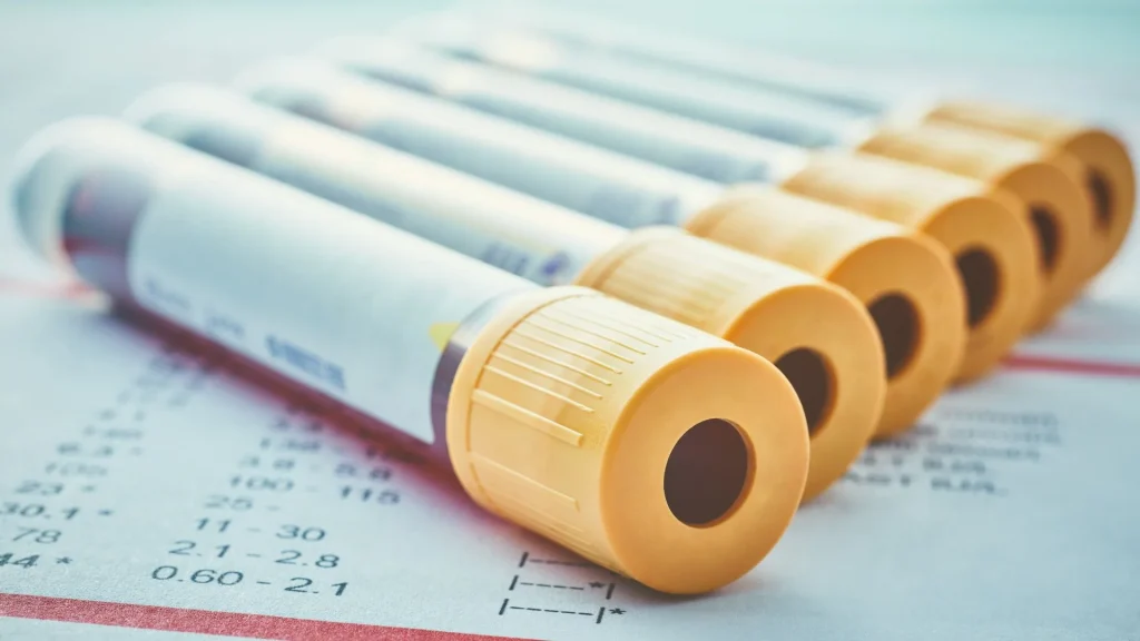 C-Reactive Protein (CRP) adalah protein yang diproduksi oleh hati sebagai respons terhadap peradangan dalam tubuh.