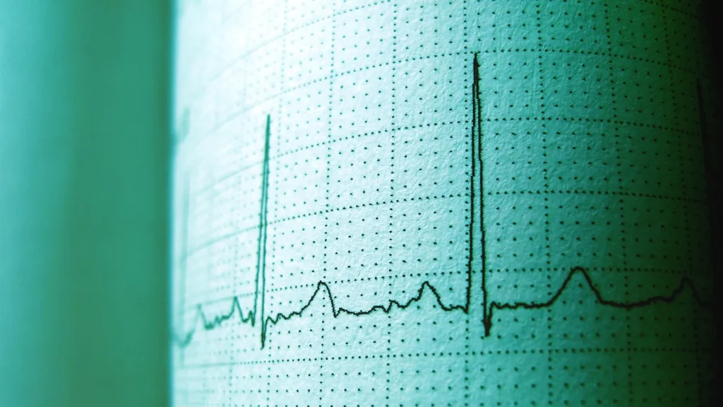 Sistem ECG modern berbasis digital dan cloud menawarkan kemudahan akses serta pemantauan real-time.
