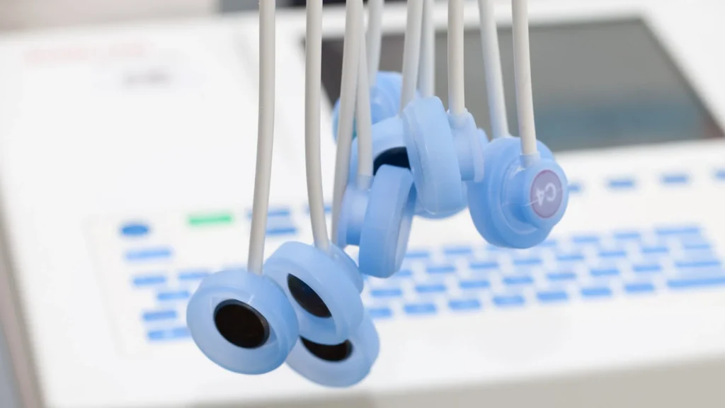 Elektrokardiogram atau ECG adalah pemeriksaan penting untuk mendeteksi gangguan pada irama dan aktivitas listrik jantung.