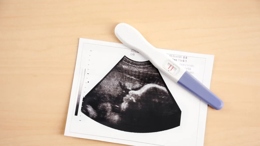 USG portable berbasis aplikasi merupakan inovasi yang menggabungkan teknologi kesehatan dengan perangkat digital modern.