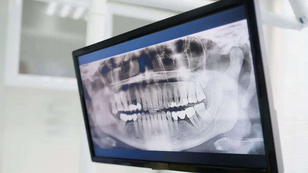 Pemeriksaan X-Ray merupakan salah satu metode pencitraan medis yang paling umum digunakan.