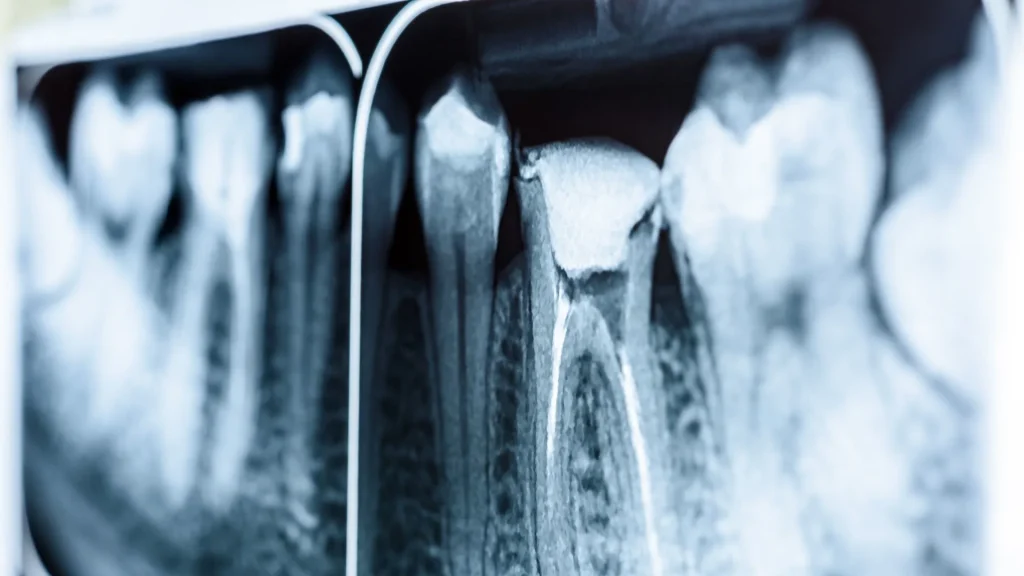 Radiologi merupakan salah satu bidang medis yang mengalami perubahan besar dengan hadirnya teknologi digital.