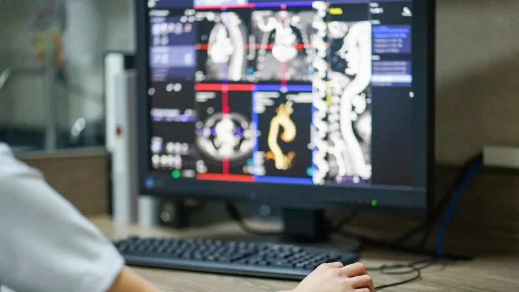 Picture Archiving and Communication System (PACS) adalah sistem digital yang dirancang untuk menyimpan, mengelola, dan mendistribusikan citra medis.