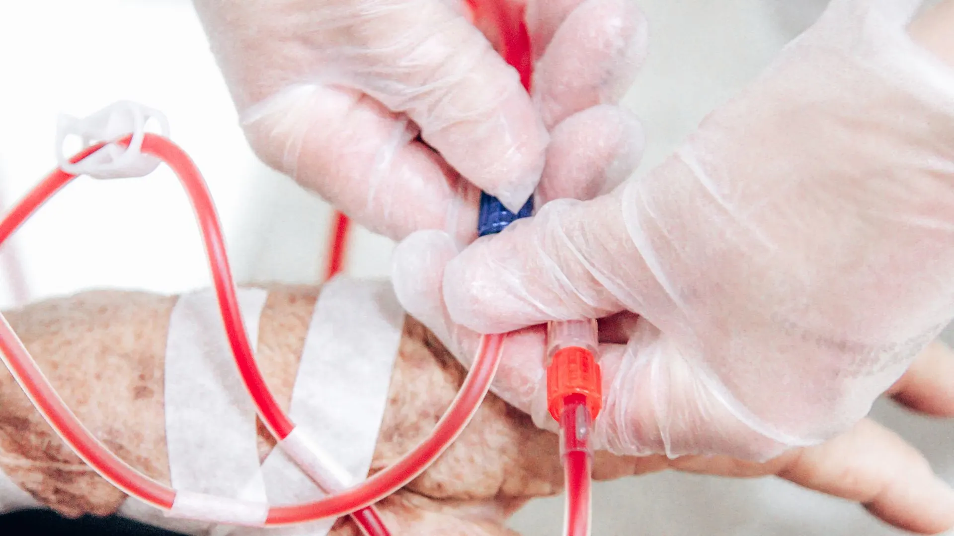 Home dialysis merupakan bentuk inovatif dari terapi ginjal yang memungkinkan pasien melakukan proses penyaringan darah di rumah.