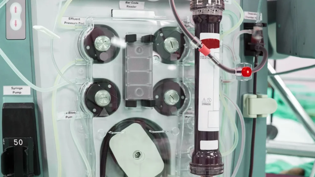 Alarm otomatis pada mesin hemodialisis berfungsi sebagai sistem pengaman utama yang memantau seluruh proses terapi secara real time.