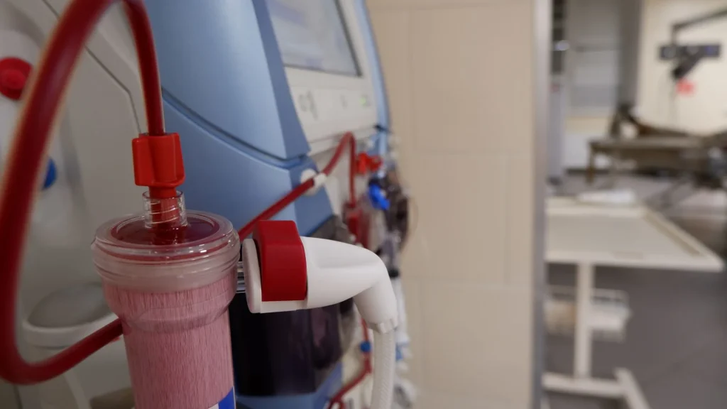 Perkembangan teknologi medis telah membuka peluang baru dalam penanganan gagal ginjal, salah satunya melalui transplantasi ginjal buatan.