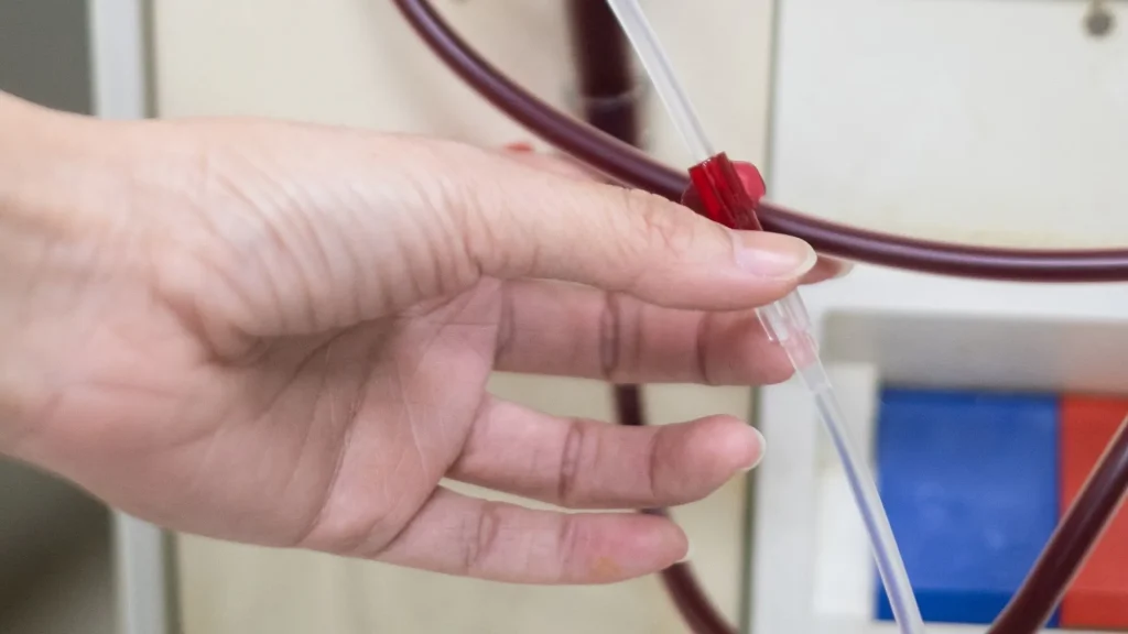 Perkembangan teknologi medis terus membawa perubahan besar dalam dunia hemodialisis.